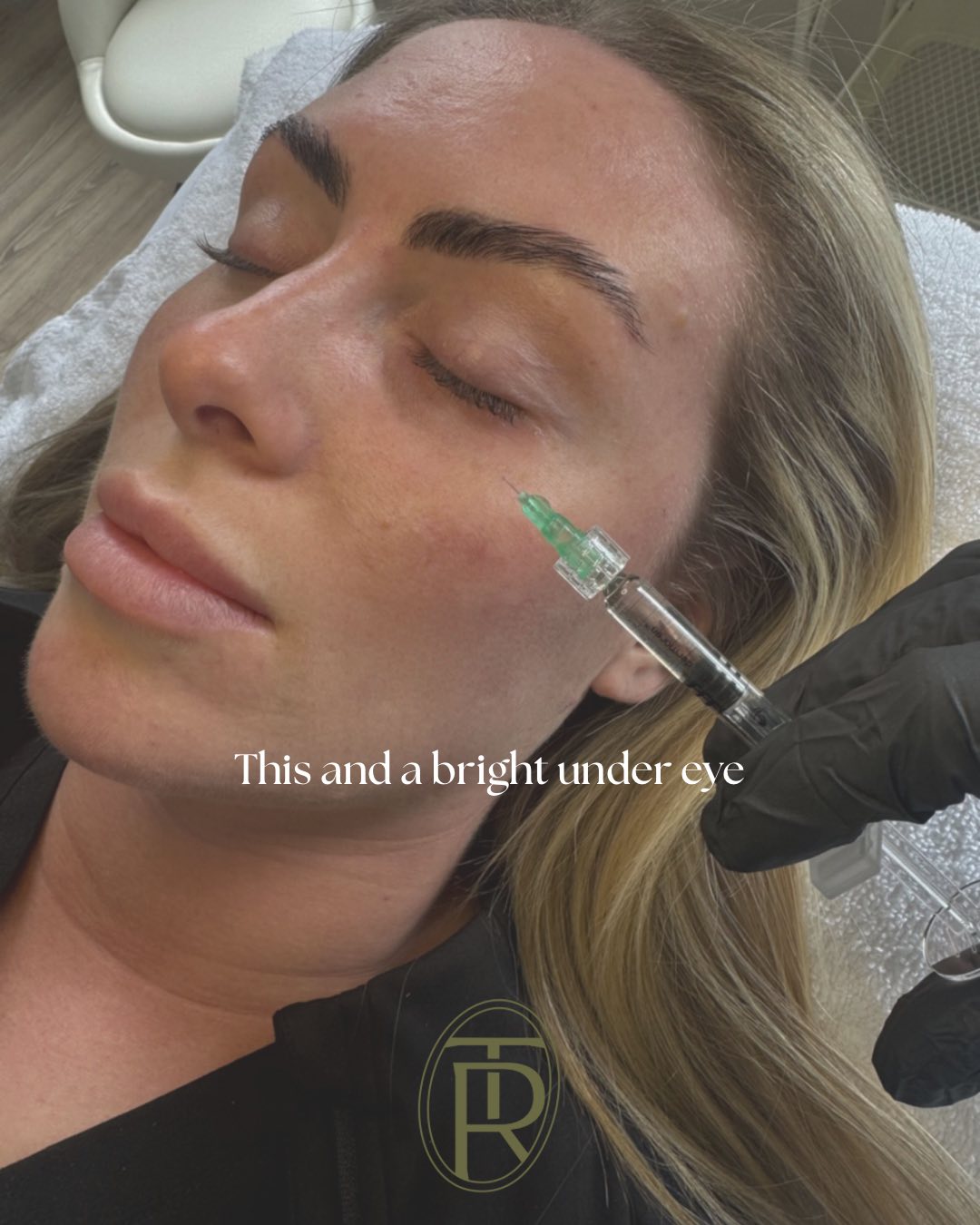 Skin booster treatment at Trēs Studios